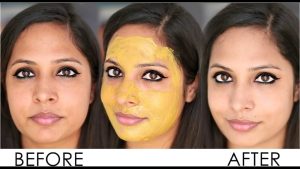 ಬಿಸಿಲಿನಿಂದ ಕಪ್ಪಾಗಿದ್ದರೆ ಈ ಫೇಸ್ ಪ್ಯಾಕ್ ಬಳಸಿ